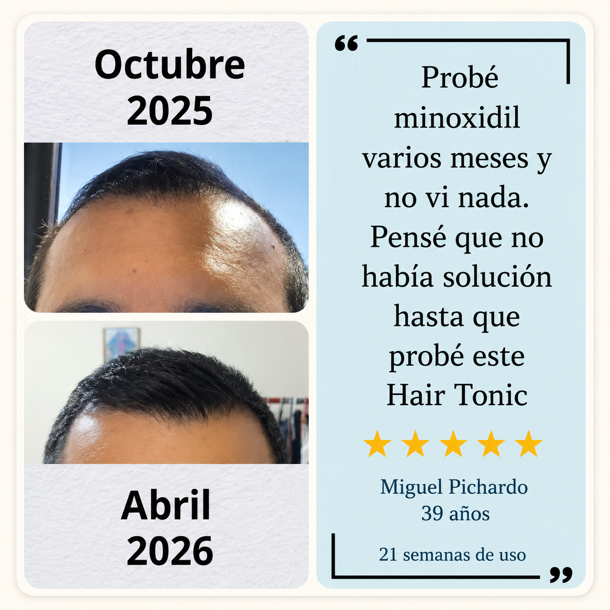 Hair Tonic - Crecimiento Capilar